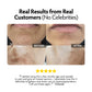 Skincorrect+ Complete System for Dull Skin, Dark, Uneven Patches and Dark Spots