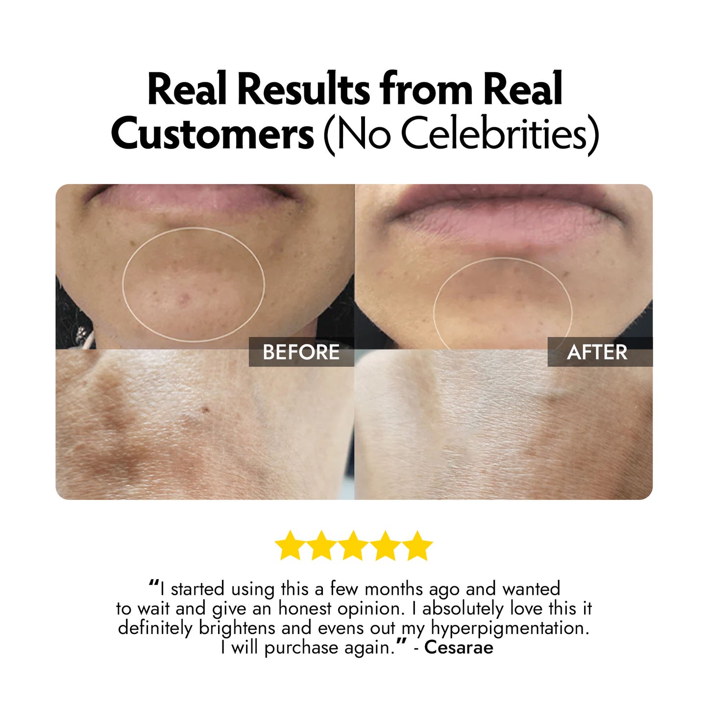 Skincorrect+ Complete System for Dull Skin, Dark, Uneven Patches and Dark Spots