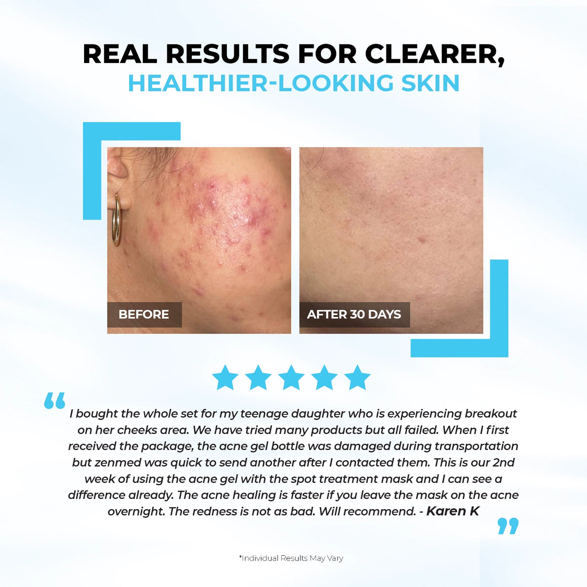 Dermacleanse ClearStart Kit